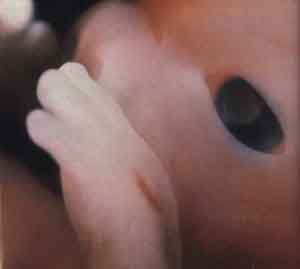 На восьмой неделе жизни эмбрион имеет рост 3,5 см., весит 13 грамм. Он открывает глазик, который пока не имеет век. Его ручки и ножки уже видны отчетливо.